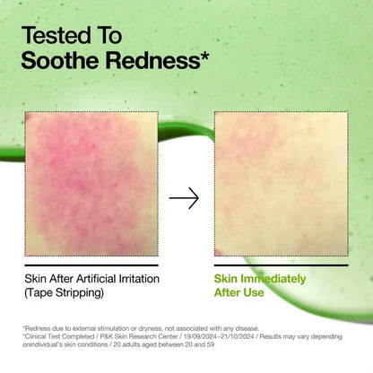 Anua Azelaic Acid 10 Hyaluron Redness Soothing Serum 30ml - Sérum apaisant pour peaux sensibles cruelty-free - rougeurs et irritation - Skincare coréenne Skinorea shop France Paris livraison rapide - Kbeauty Korean Skinorea shop Europe fast delivery - yesstyle