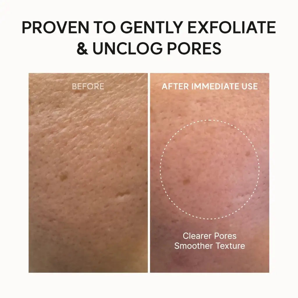 Arencia Fresh Green Rice Mochi Cleanser 120g - Résultats avant après Arencia Mochi Cleanser points noirs pores affinés - Kbeauty Korean skincare Europe fast delivery - Skincare coréenne Skinorea shop Paris France livraison rapide - yesstyle