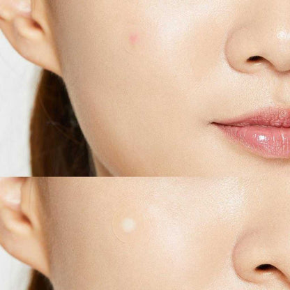 COSRX Acne Pimple Master Patch 24 patches - Patchs hydrocolloïdes pour l'acné